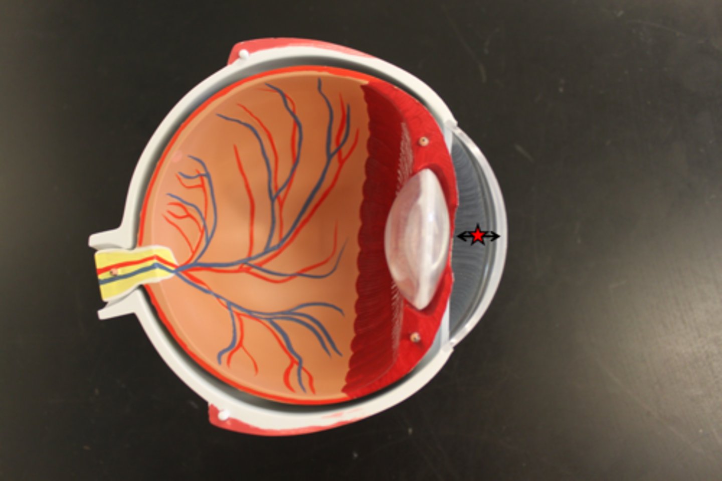 <p>Name this chamber of the eyeball</p>