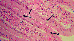 <p>Identify cells; disregard arrows/numbers</p>