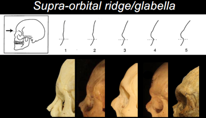 <p>Supra-Orbital Ridge - Cranial</p>