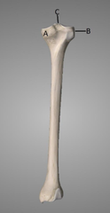 <p>B</p>