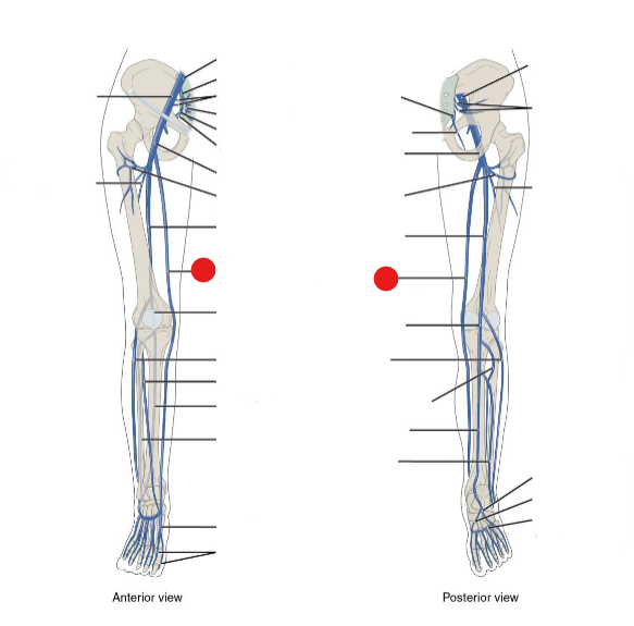 <p>Identify the structure pinned</p>