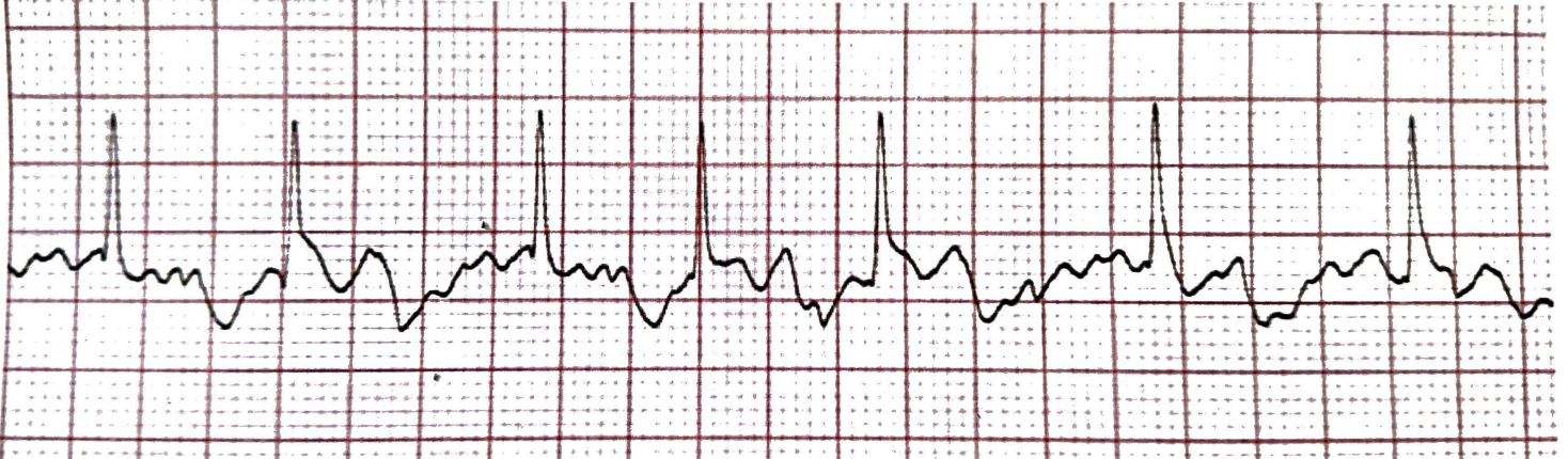 <p>What rhythm is this + bpm</p>