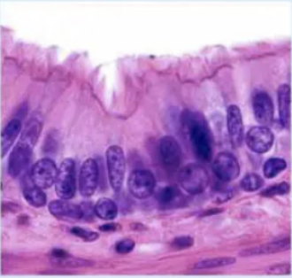 <p><strong>pseudostratified columnar</strong>: physical appearance </p>