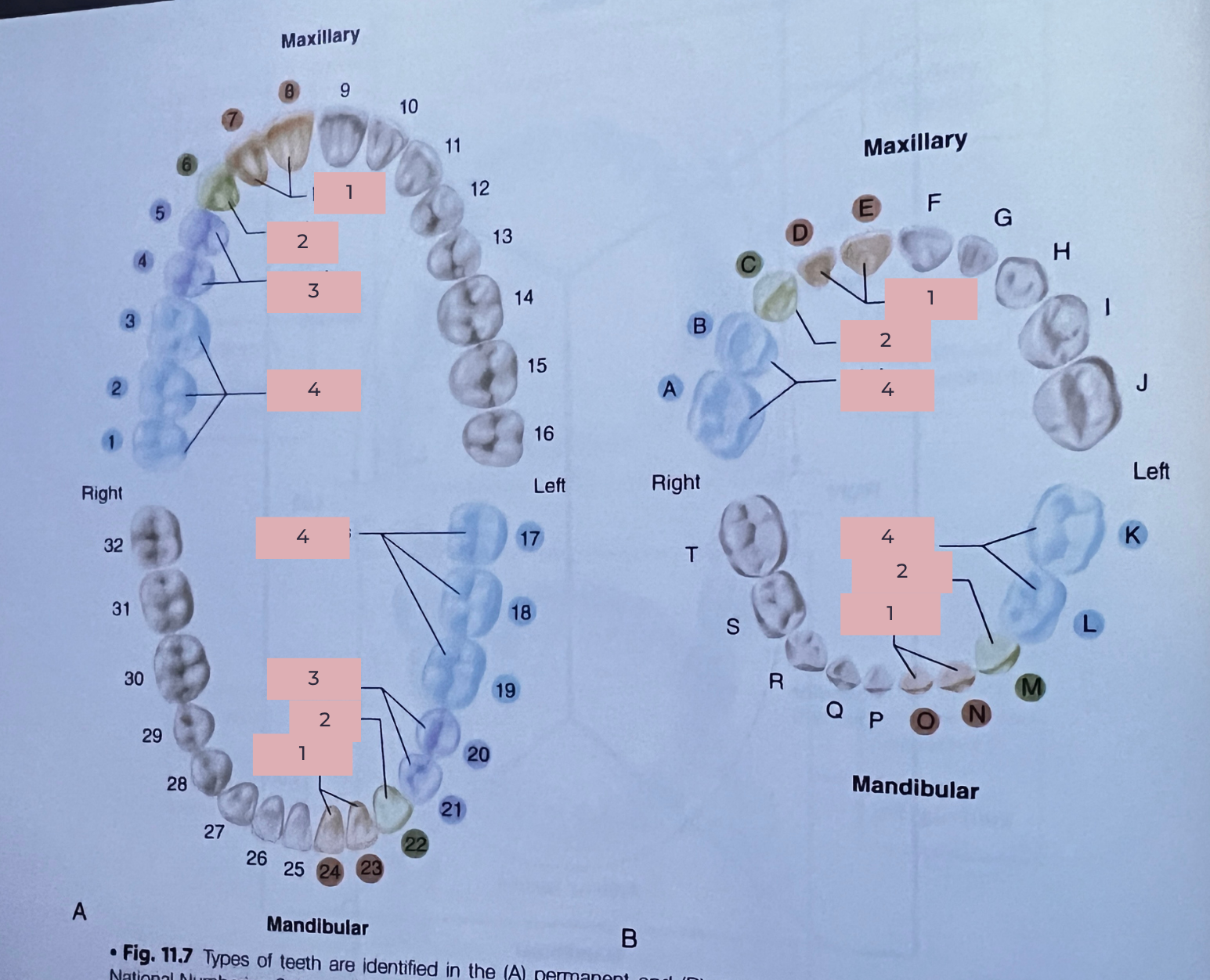 <p>What type of teeth are labeled 1?</p>