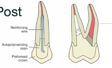 <p>Why is it not essential that the reline material extend all the way down the post space?</p>