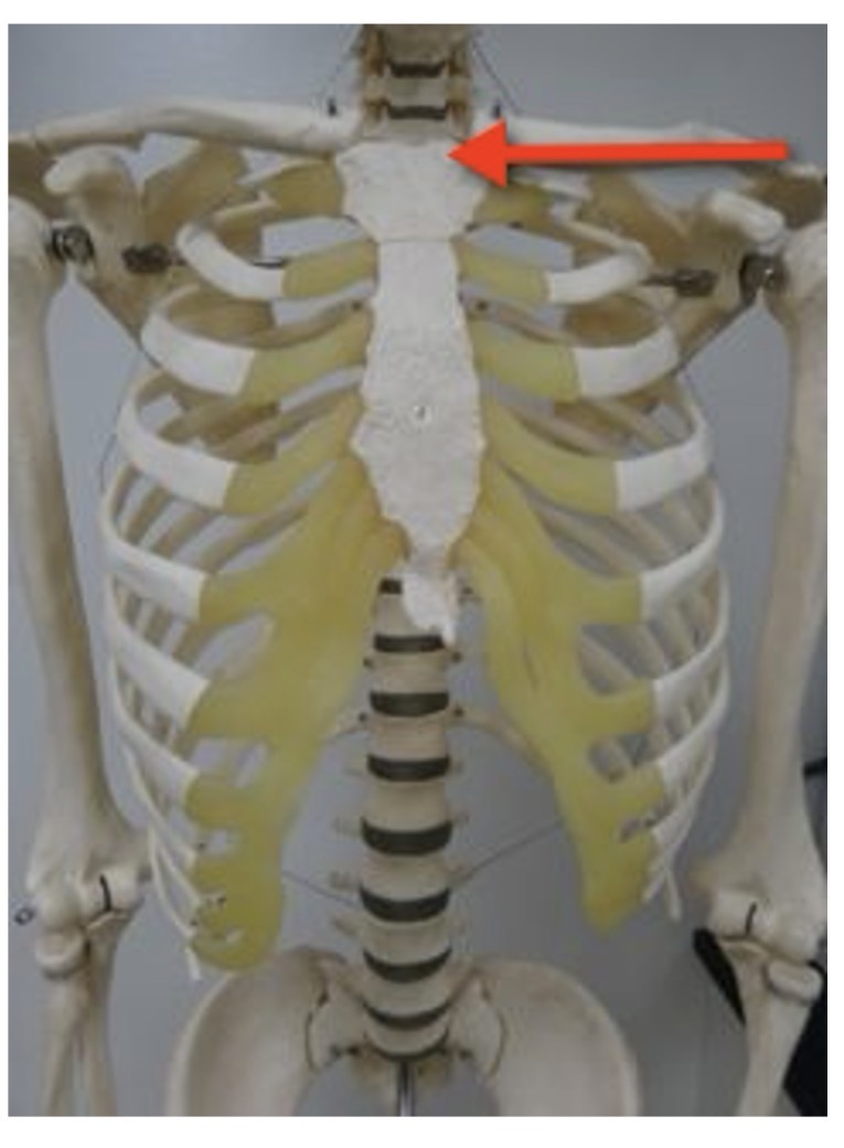 <p>Name the directional term (toward the middle line of the body)</p>
