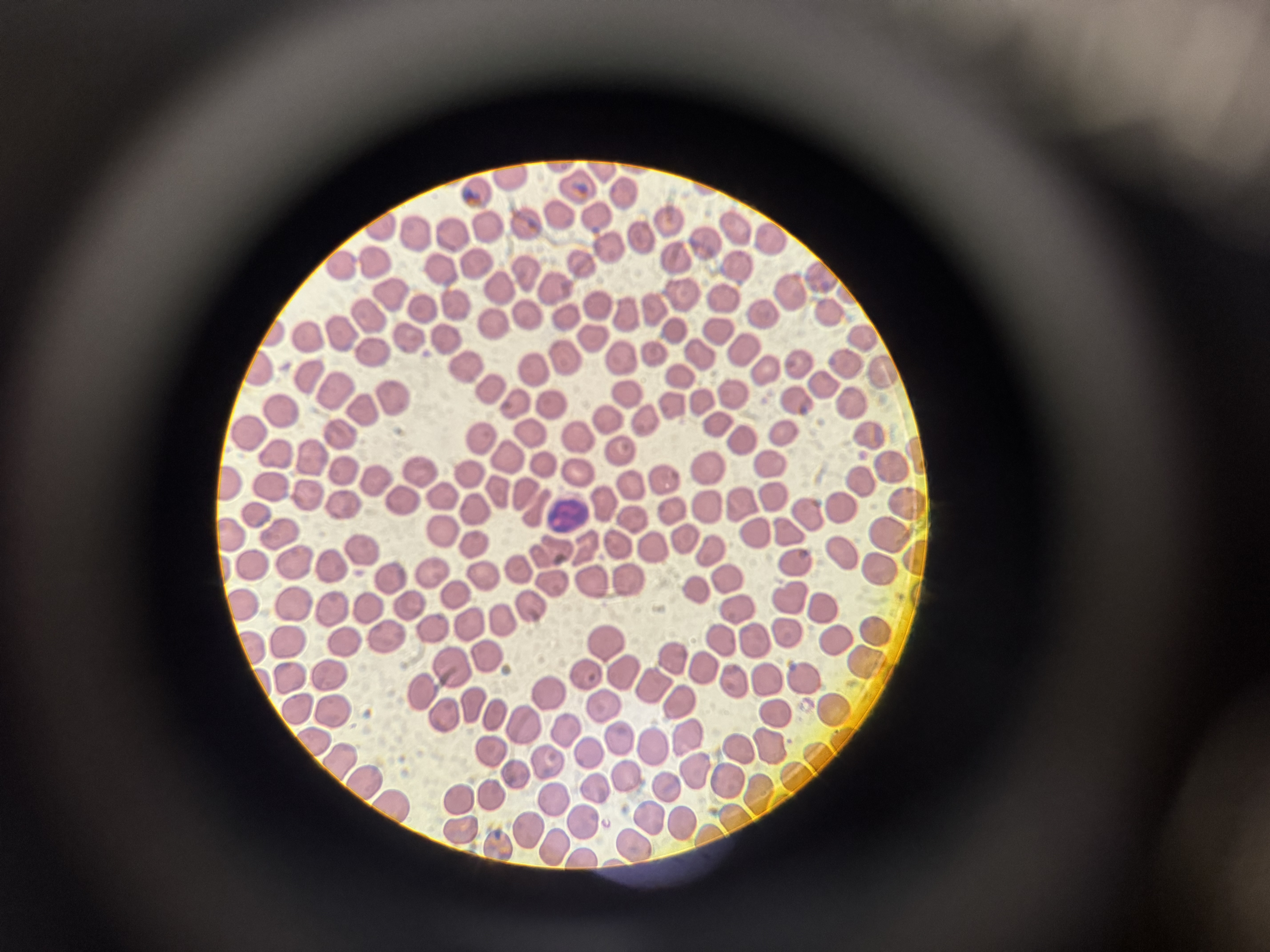 <p>a) Which WBC is this?</p><p>b) Describe the nucleus.</p><p>c) Size?</p><p>d) Function?</p>