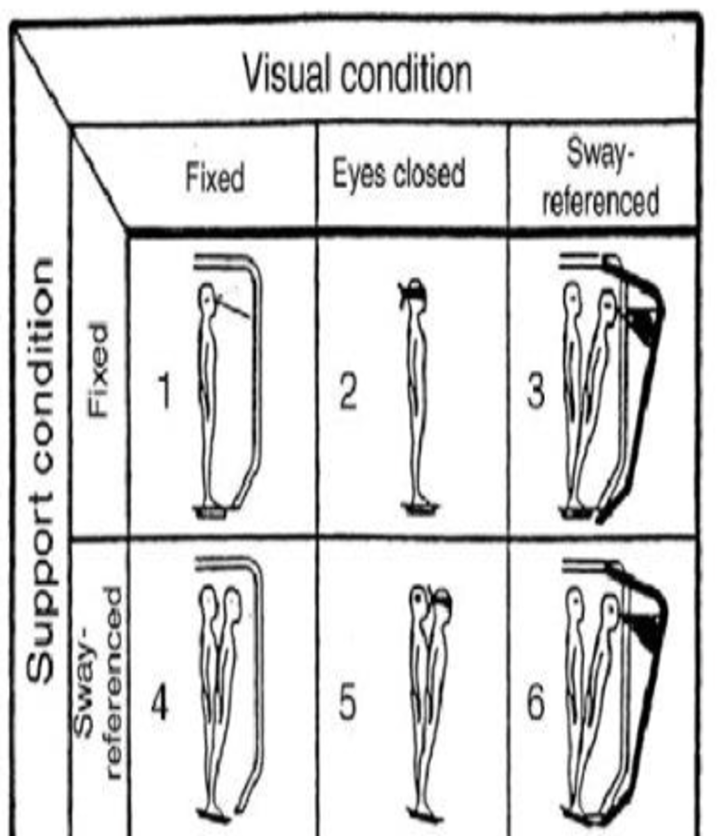 <p>- Eyes open, foam surface</p><p>- Vision: eyes open</p><p>- Surface: sway referenced</p><p>- Disadvantaged system: somatosensory absent</p>