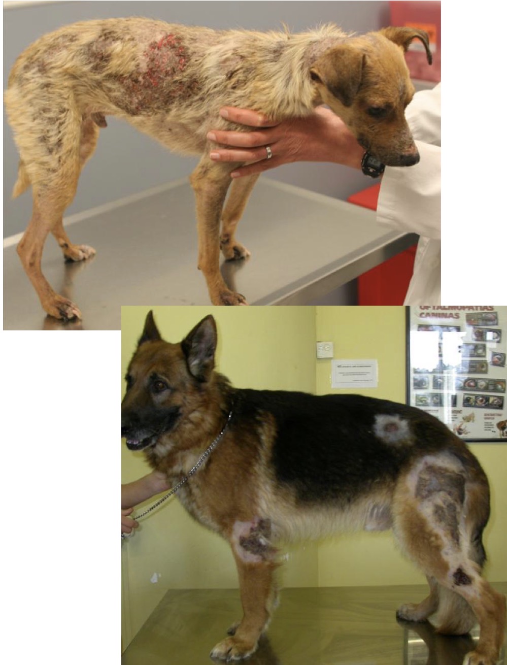 <p>Deep Bacterial Folliculitis/Furunculosis (DBFF)</p>