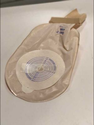 <p>If one of our patients had the object below, what do we need to consider for therapy purposes?</p>