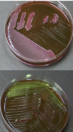 <p>On <strong>Eosin-methylene blue (EMB) agar</strong>, how do colony colors relate to lactose fermentation strength?</p>
