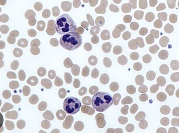 <p>Neutrophils increase in what conditions?</p>