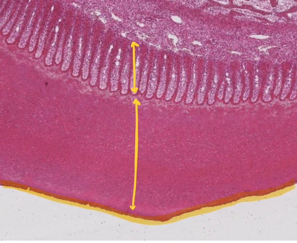 <ul><li><p>stratum externum</p><ul><li><p>periople</p></li></ul></li><li><p>straum medium</p><ul><li><p>horn tubules</p></li></ul></li><li><p>stratum lamellatum</p><ul><li><p>epidermal lamellae</p></li></ul></li></ul><p></p>