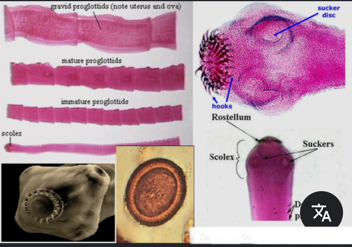<p>Cestode (Tapeworm) located in the small intestine that contains scolexes with 2 rows of hooks one lateral genital pore</p><p>Eggs have striated shell with 6 hooks inside the ova</p>