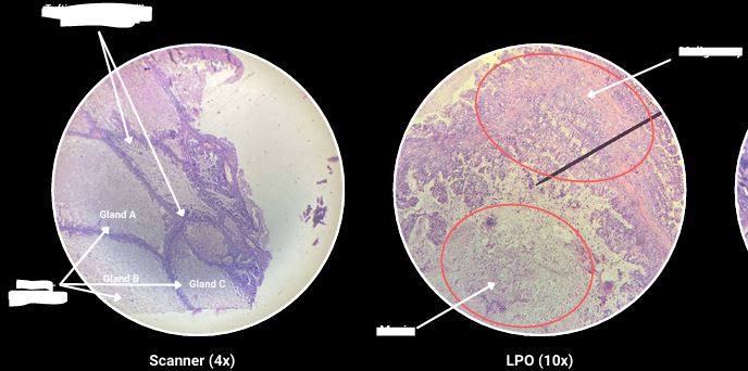 <p>What are the arrows pointing?</p>