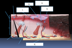 <p>What part of the burned skin model is the section labeled #1?</p>