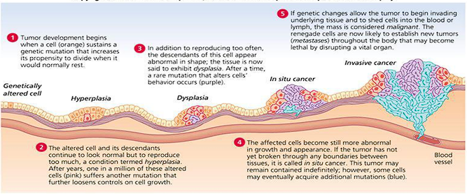<ul><li><p><span style="color: red;">Genetically altered cell</span> that sustains a mutation increasing its propensity to divide.</p></li></ul><ul><li><p><span style="color: red;"><strong>Hyperplasia:</strong></span> The cells look normal but reproduce too much.</p></li><li><p><span style="color: red;"><strong>Dysplasia</strong></span><strong>:</strong> The cells appear abnormal in shape.</p></li><li><p><span style="color: red;"><strong>In situ cancer:</strong></span> Affected cells become more abnormal in growth and appearance but remain contained without breaking boundaries.</p></li><li><p><span style="color: red;"><strong>Invasive cancer / Metastases:</strong></span> The mass becomes malignant, invading underlying tissue, shedding cells into the blood or lymph, and establishing new lethal tumors throughout the body.</p></li></ul><p></p>