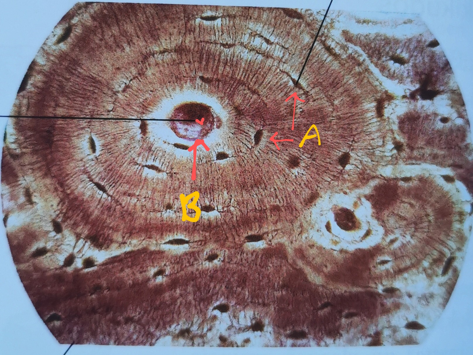 <p>Poikkileikkaus luusta</p>