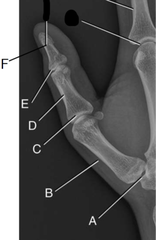 <p>B?</p>