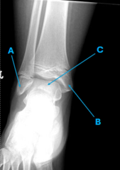<p>C</p>