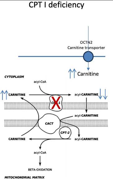 <ul><li><p>fxn: acyl-coa → acylcarnitine</p></li><li><p>hypoketoic hypoglycemia, <u>high free carnitine, low acyl carnitine</u></p></li><li><p>hepatomegaly, poor feeding, lethargic, hypotonic</p></li></ul><p></p>