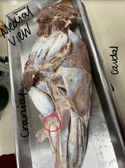 <p>a fibrous structure connecting the biceps brachii with epimysium of the extensor carpi radialis</p>