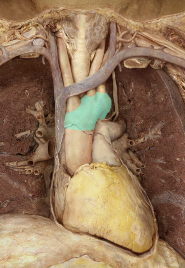 <p>Identify the artery of the head/neck/body cavities</p>