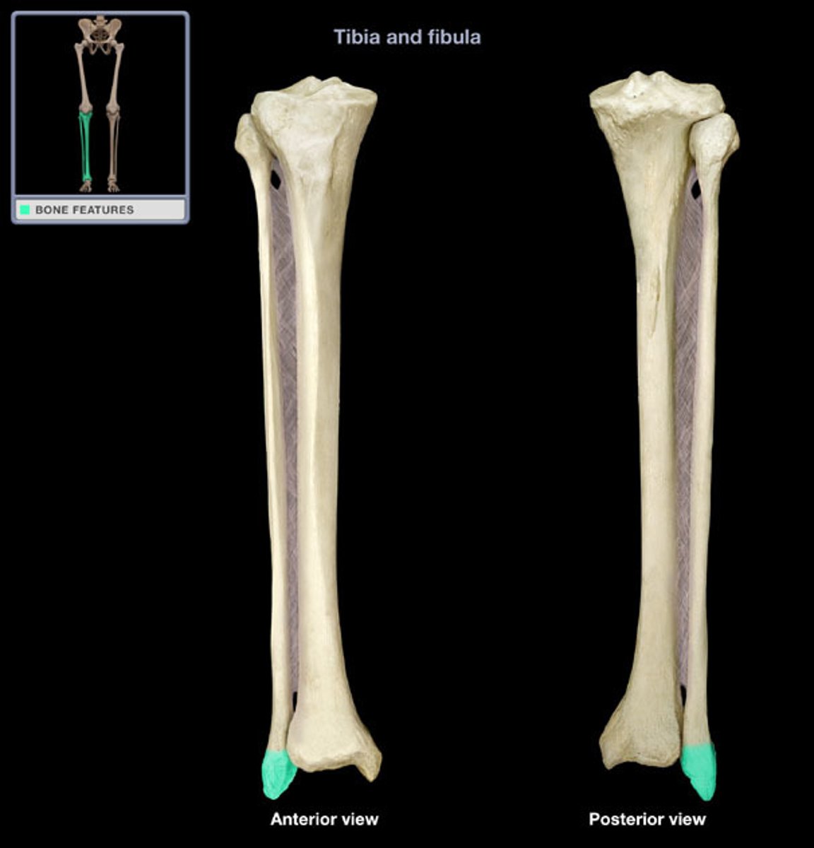 <p>(what bone and bone marking)</p>