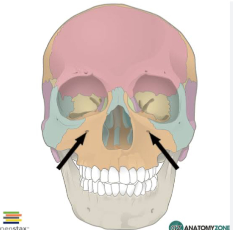 <p>What figure are the black arrows pointing too? What would a lesion to this cause?</p>