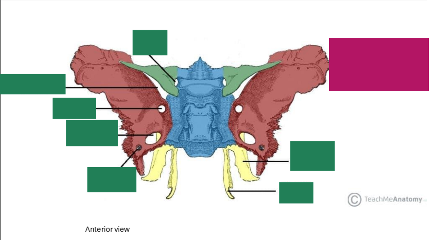 <p><strong>Label the sphenoid Bone</strong></p>