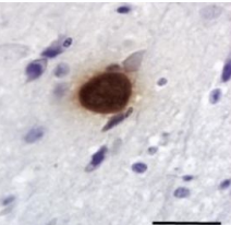 <p>cattle-histopath of fetus or placenta, PCR, ELISA </p>