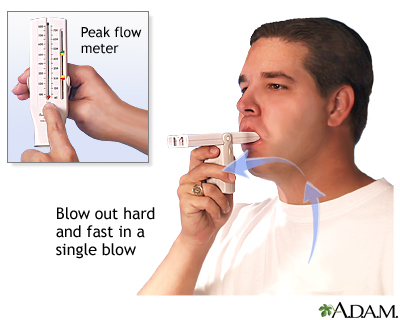 <p>peak expiratory flow (PEF), or how quickly a patient can force air out of their lungs in L/min</p><ul><li><p>common to monitor asthma</p></li><li><p>helps to identify worsening airway obstruction before symptoms cecome severe</p></li></ul><p></p><p><strong>How to Perform a Peak Flow Measurement</strong></p><p>Correct technique is essential for obtaining a useful peak flow value. Because the test is highly effort dependent, the respiratory therapist or clinician must explain and demonstrate the maneuver clearly.</p><p><strong>The basic steps include:</strong></p><ol><li><p>Set the peak flow meter to zero.</p></li><li><p>Have the patient sit or stand upright.</p></li><li><p>Instruct the patient to take the deepest breath possible.</p></li><li><p>Have the patient place the mouthpiece in the mouth with the tongue out of the way.</p></li><li><p>Make sure the lips form a tight seal around the mouthpiece.</p></li><li><p>Instruct the patient to blow out as hard and fast as possible.</p></li><li><p>Record the value.</p></li><li><p>Repeat the maneuver until three acceptable efforts are obtained.</p></li><li><p>Record the highest value.</p></li></ol><p>The patient does not need to exhale completely for several seconds. Peak flow focuses on the fastest burst of air at the beginning of expiration, not the total amount of air exhaled.</p><p></p>