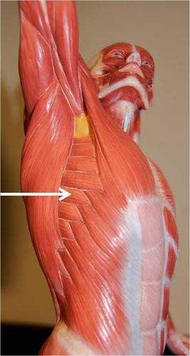 <p>What muscle is this?</p>