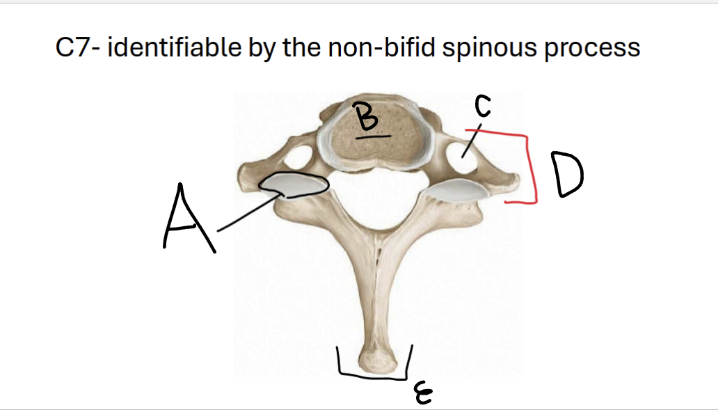 <p>E</p>