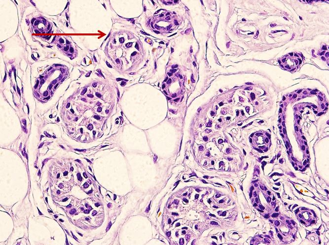 <p>Tế bào gì ?</p>