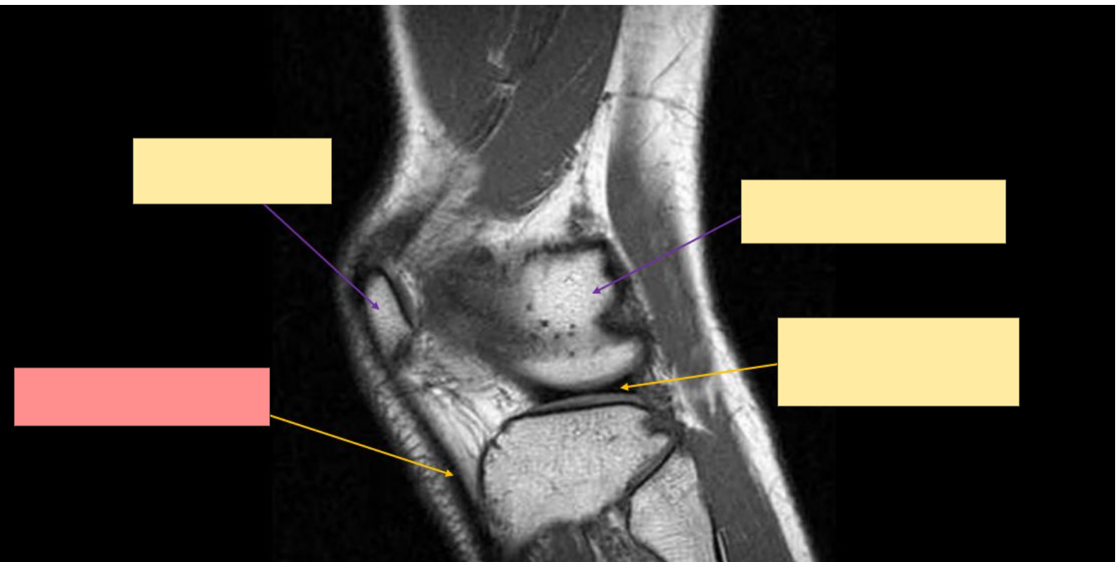 <p>Identify the structure</p>