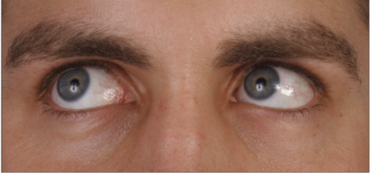 <p>Control movement of eye</p>