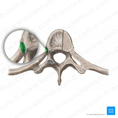 <ul><li><p>plane (gliding) motion</p></li><li><p>diarthrodial</p></li><li><p>between rib and vertebral body</p></li></ul><p></p>
