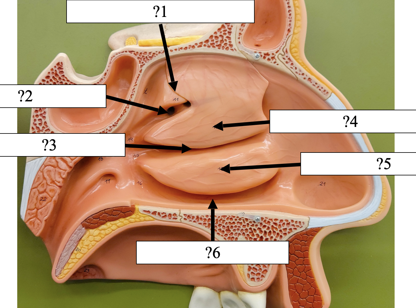 <p>5 Name the bone?</p>