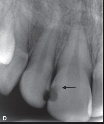 <p>what is this arrow pointing at?</p>