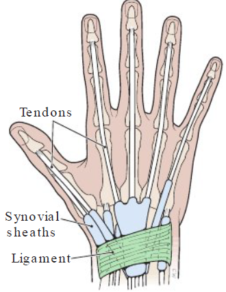 <p><strong>Definition</strong></p><ul><li><p>Inflammation fo tendons of wrist from strain</p></li></ul><p></p><p><strong>Causes</strong></p><ul><li><p>Extending hand up and down at wrist</p></li></ul><p></p><p><strong>Symptoms</strong></p><ul><li><p>Pain in wrist, outer edges of hand</p></li></ul><p></p>