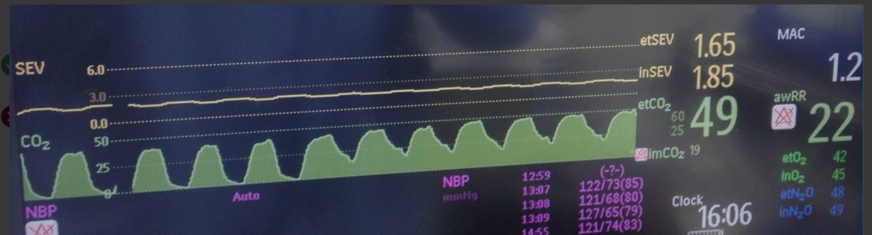 <p>What most likely would resolve the underlying cause of this capnography waveform?</p><p>A. Change soda lime</p><p>B Fix inspiratory valve</p><p>C. Increases FGF</p><p>D. increase MV</p>