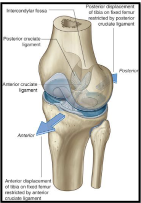 <p>Anterior Cruciate Ligament (ACL)</p>