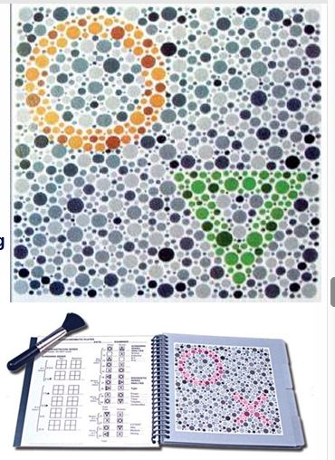 <p><strong>Test Tritan defects, and diagnostic plates </strong>examines <strong>severity </strong></p><p></p><p>like Ishihara but only symbols. Similar sensitivity and specificity </p><ul><li><p>may detect Tritan defects </p></li><li><p>includes <strong>screening plates</strong> to test P, D and T</p><ul><li><p>if a pass is obtained CV id normal </p></li></ul></li><li><p>14 <strong>diagnostic plates </strong>provide type and extent (mild, moderate or severe) of defect</p><ul><li><p>not perfect </p></li></ul></li></ul><p></p>