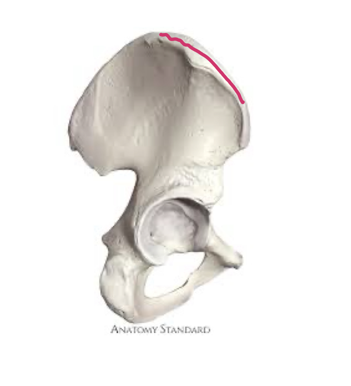 <p>Top ridge of hip bone </p>
