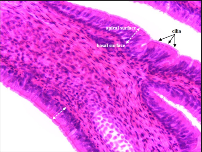 <p>Pseudostratified Columnar epithelium</p>