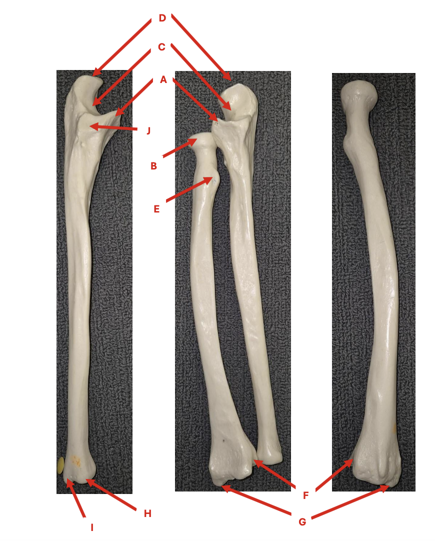 <p>Identify each labelled structure in the image and state the view of each ulna and radius</p>