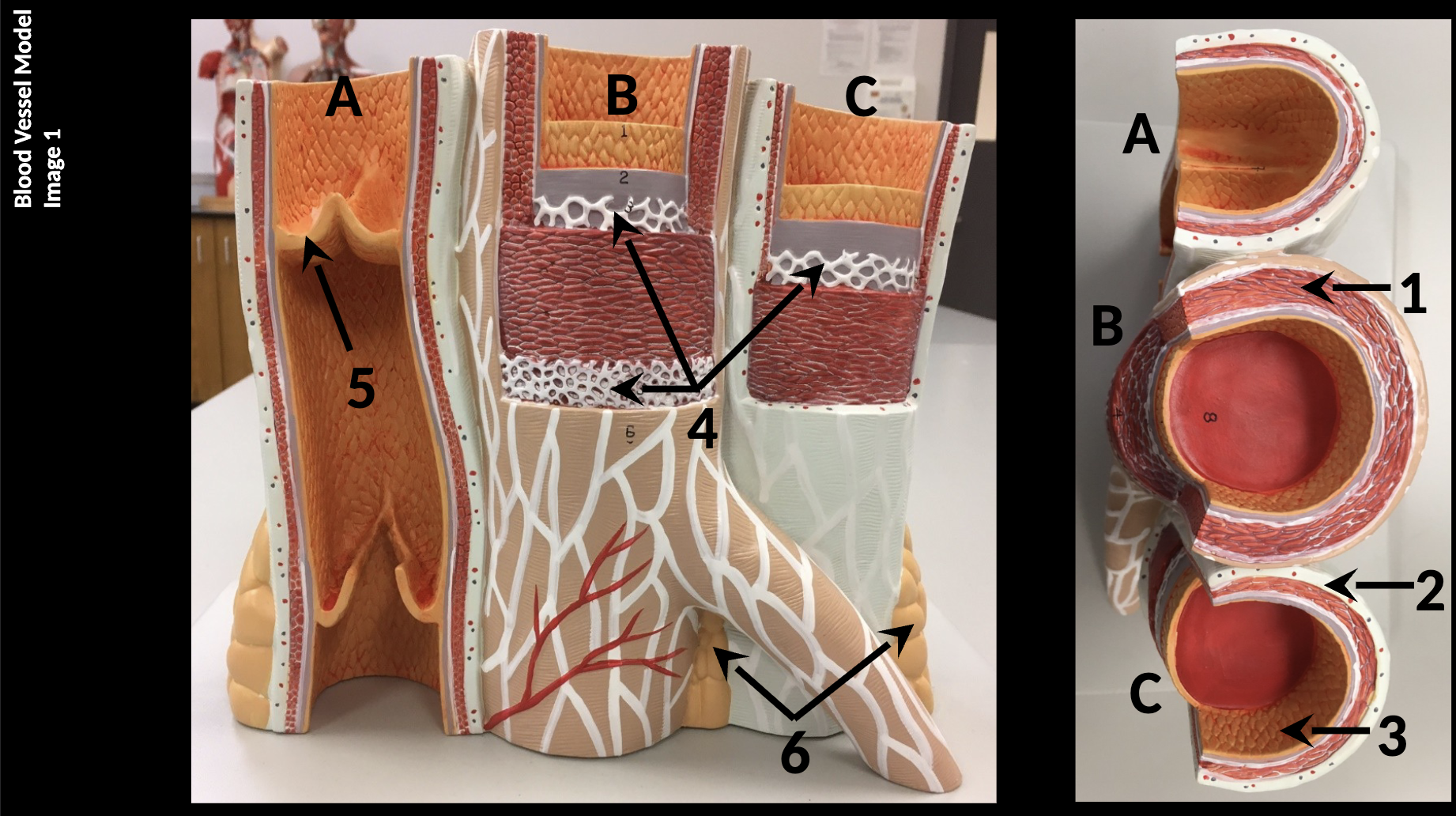 <p>A - Vein</p><p>B - Artery</p><p>C - Vein</p><p>1) Tunica Media</p><p>2) Tunica Externa</p><p>3) Tunica Intima</p><p>4) Elastic Tissue/ Lamina</p><p>5) Valve</p><p>6) Adipose Tissue</p>