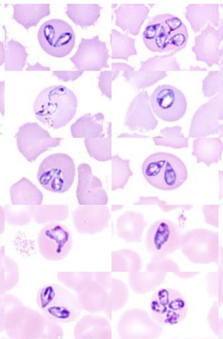<p>Name: Babesia bigemina</p><p class="p1">Stage: trophozoite</p>