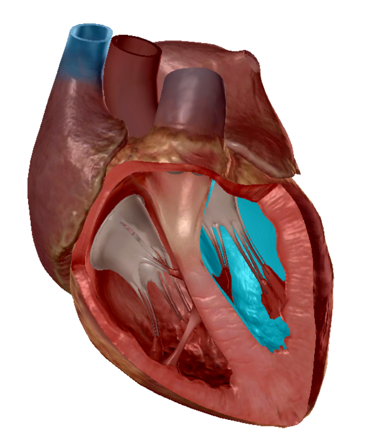term image